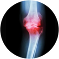 Bone On Bone