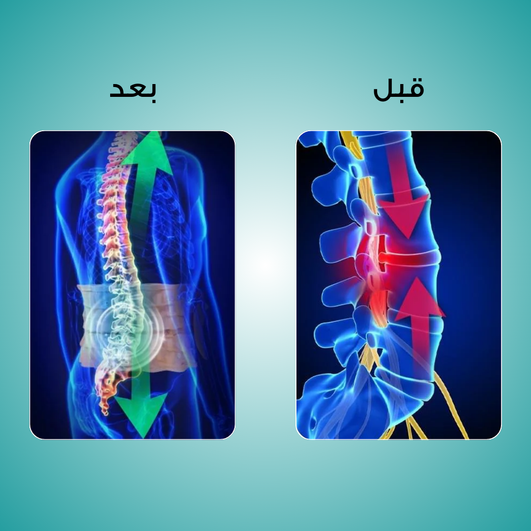 سوبر ريليف - حزام فك الضغط والعلاج الحراري