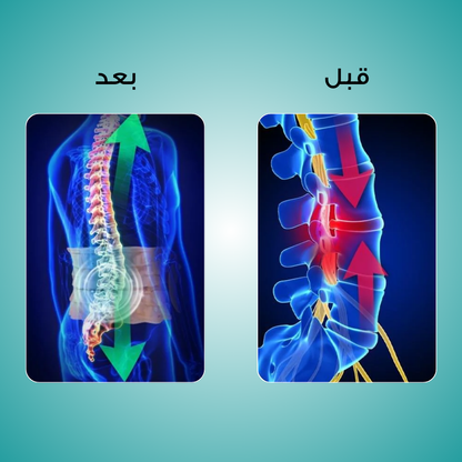 سوبر ريليف - حزام فك الضغط والعلاج الحراري